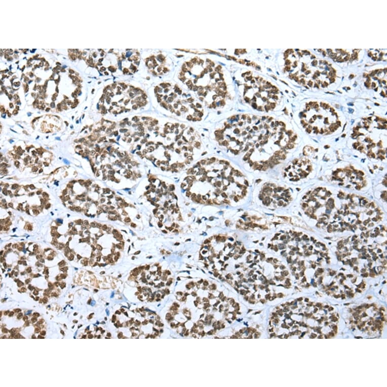 Immunohistochemistry - TBP Antibody from Signalway Antibody (43335) - Antibodies.com