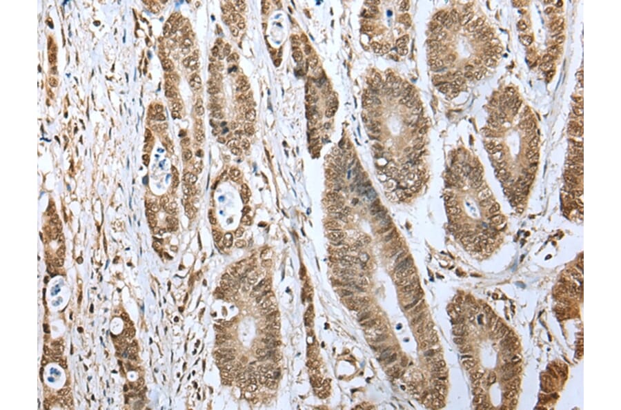 Immunohistochemistry - TBP Antibody from Signalway Antibody (43335) - Antibodies.com