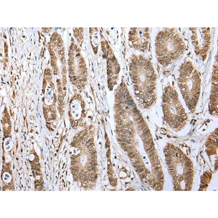 Immunohistochemistry - TBP Antibody from Signalway Antibody (43335) - Antibodies.com