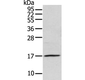 NDP Antibody from Signalway Antibody (43361) - Antibodies.com