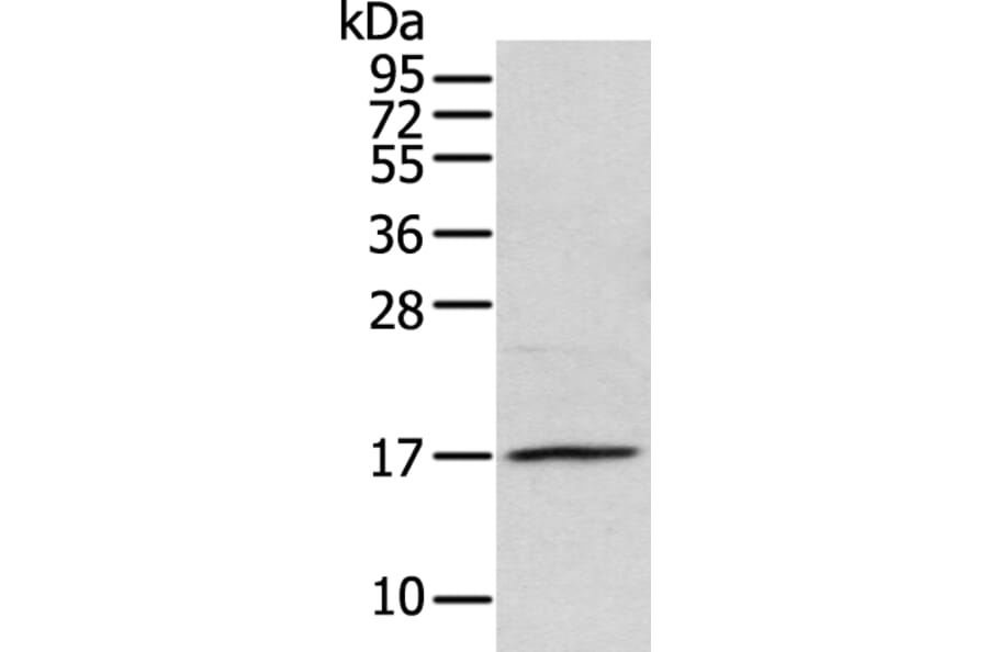 NDP Antibody from Signalway Antibody (43361) - Antibodies.com