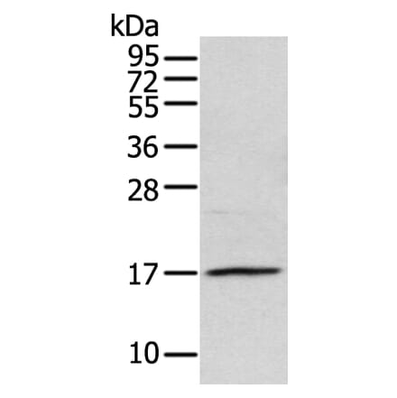 NDP Antibody from Signalway Antibody (43361) - Antibodies.com