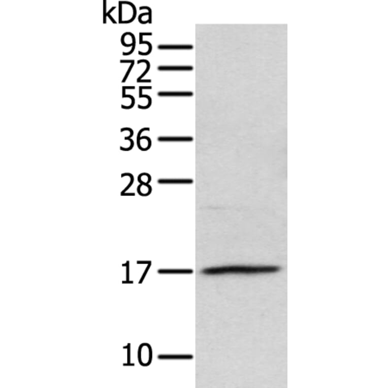 NDP Antibody from Signalway Antibody (43361) - Antibodies.com