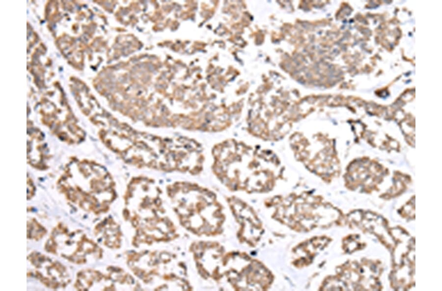 Immunohistochemistry - NDP Antibody from Signalway Antibody (43361) - Antibodies.com