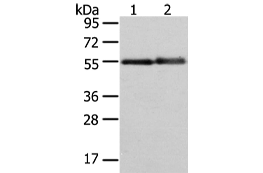 XK Antibody from Signalway Antibody (43438) - Antibodies.com