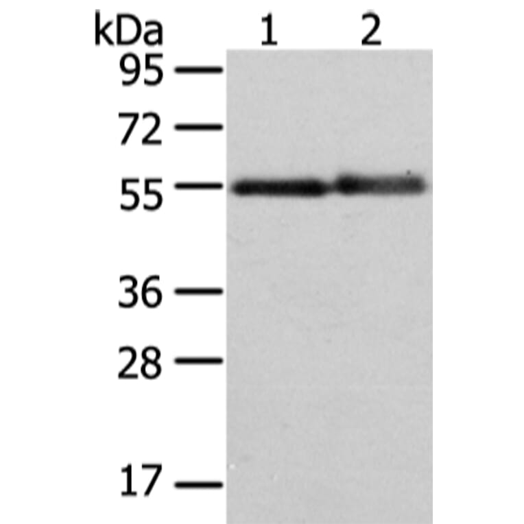 XK Antibody from Signalway Antibody (43438) - Antibodies.com