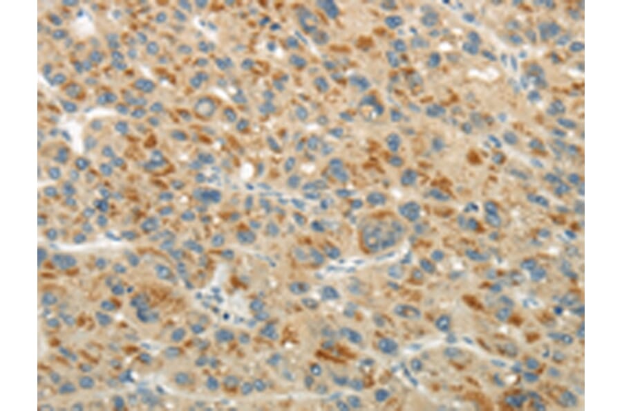 Immunohistochemistry - XK Antibody from Signalway Antibody (43438) - Antibodies.com