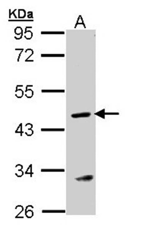Anti-Argininosuccinate Lyase Antibody (A39189) | Antibodies.com