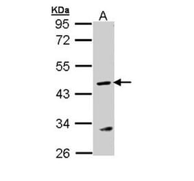 Argininosuccinate Lyase antibody from Signalway Antibody (22249) - Antibodies.com