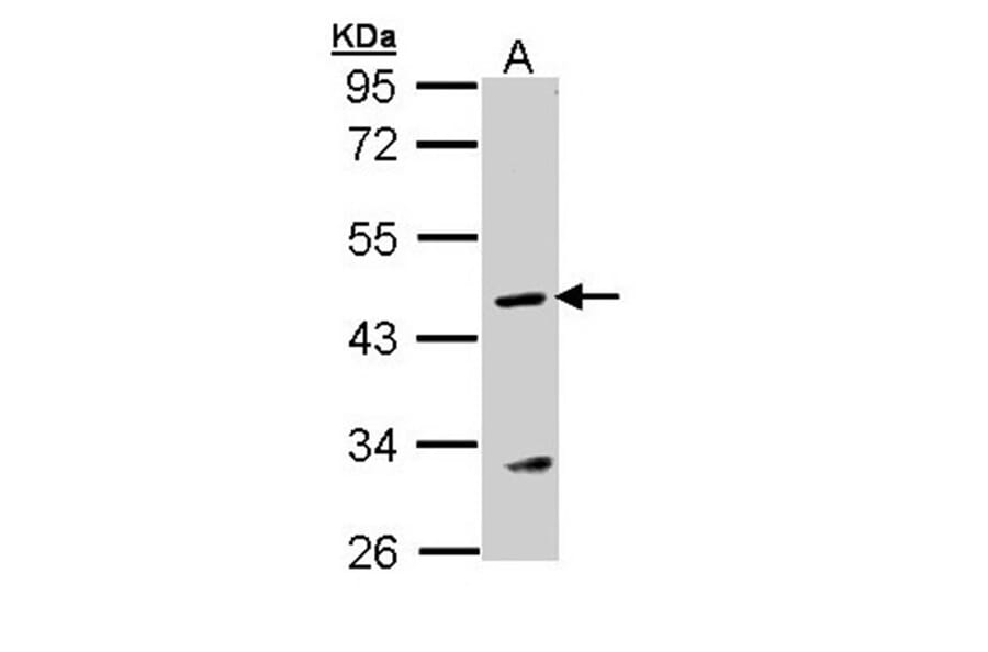 Argininosuccinate Lyase antibody from Signalway Antibody (22249) - Antibodies.com