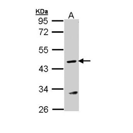 Argininosuccinate Lyase antibody from Signalway Antibody (22249) - Antibodies.com