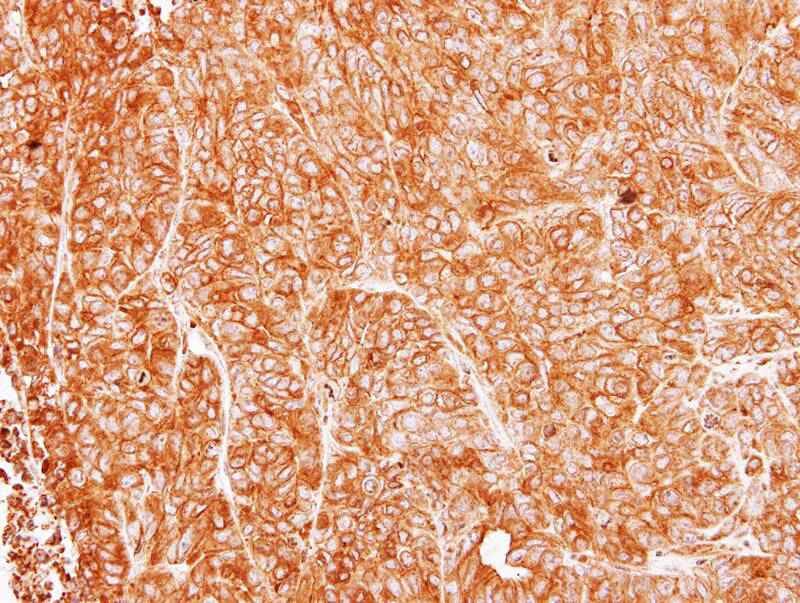 アーチーCS ー Antibodies.com | (A39189) Antibody Lyase Anti-Argininosuccinate ー 現存性Neutraling デュエルマスターズ