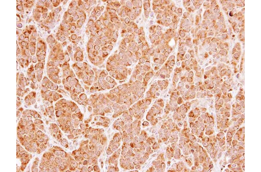 Immunohistochemistry - UNC13 (C. elegans)-like antibody from Signalway Antibody (23108) - Antibodies.com