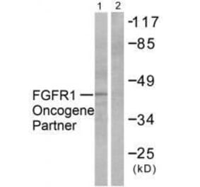 Western blot - FGFR1 Oncogene Partner Antibody from Signalway Antibody (33371) - Antibodies.com