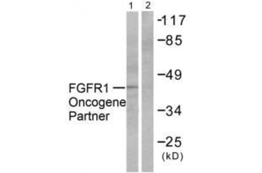 Western blot - FGFR1 Oncogene Partner Antibody from Signalway Antibody (33371) - Antibodies.com