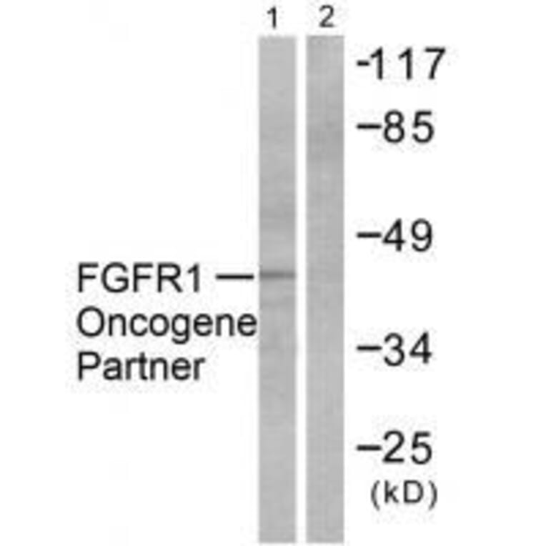Western blot - FGFR1 Oncogene Partner Antibody from Signalway Antibody (33371) - Antibodies.com