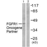 Western blot - FGFR1 Oncogene Partner Antibody from Signalway Antibody (33371) - Antibodies.com