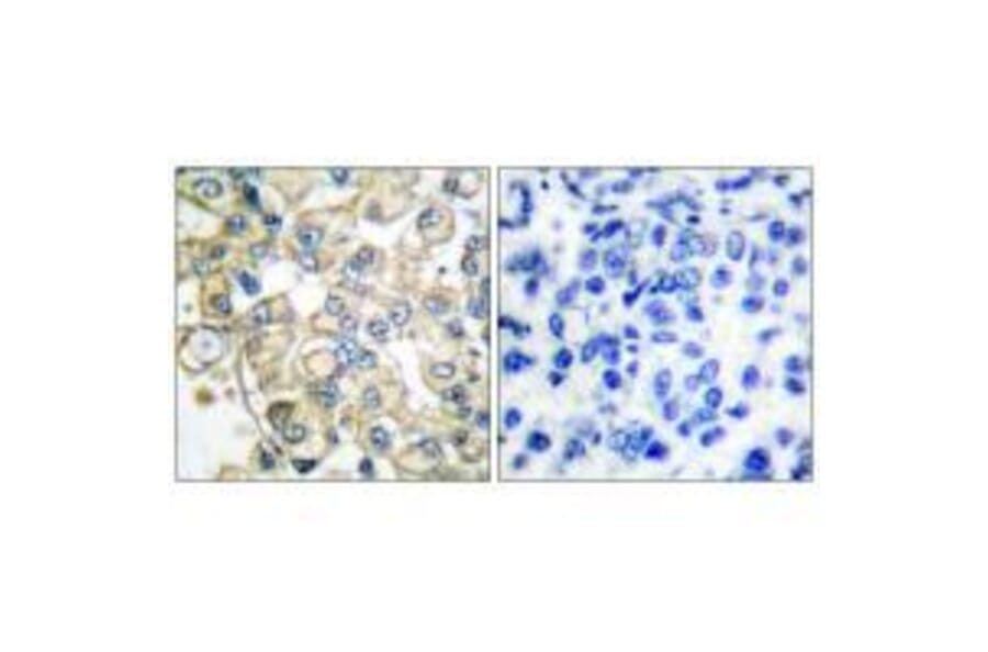 anti-fgfr1-oncogene-partner-antibody-a39191-antibodies