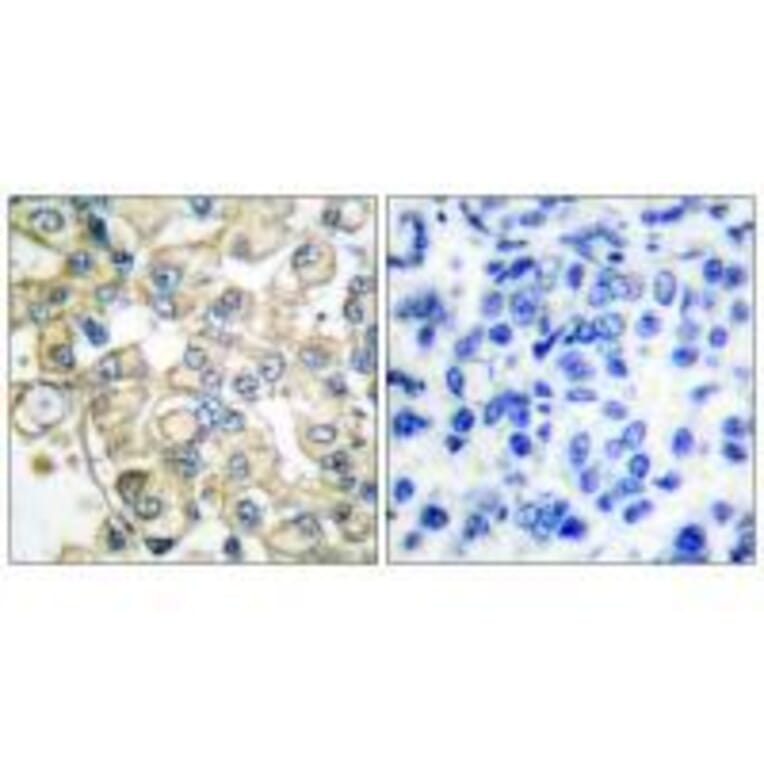 Immunohistochemistry - FGFR1 Oncogene Partner Antibody from Signalway Antibody (33371) - Antibodies.com