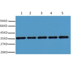 Western blot - GAPDH Rabbit Polyclonal Antibody from Signalway Antibody (37985) - Antibodies.com