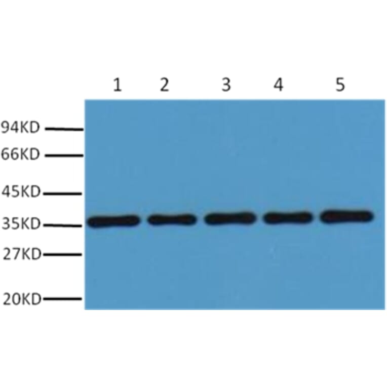 Western blot - GAPDH Rabbit Polyclonal Antibody from Signalway Antibody (37985) - Antibodies.com