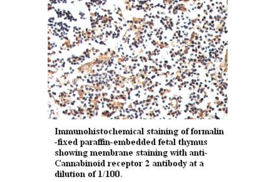Cannabinoid receptor 2 Antibody from Signalway Antibody (39417) - Antibodies.com