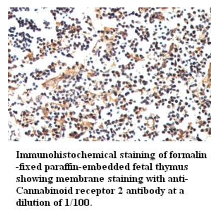 Cannabinoid receptor 2 Antibody from Signalway Antibody (39417) - Antibodies.com