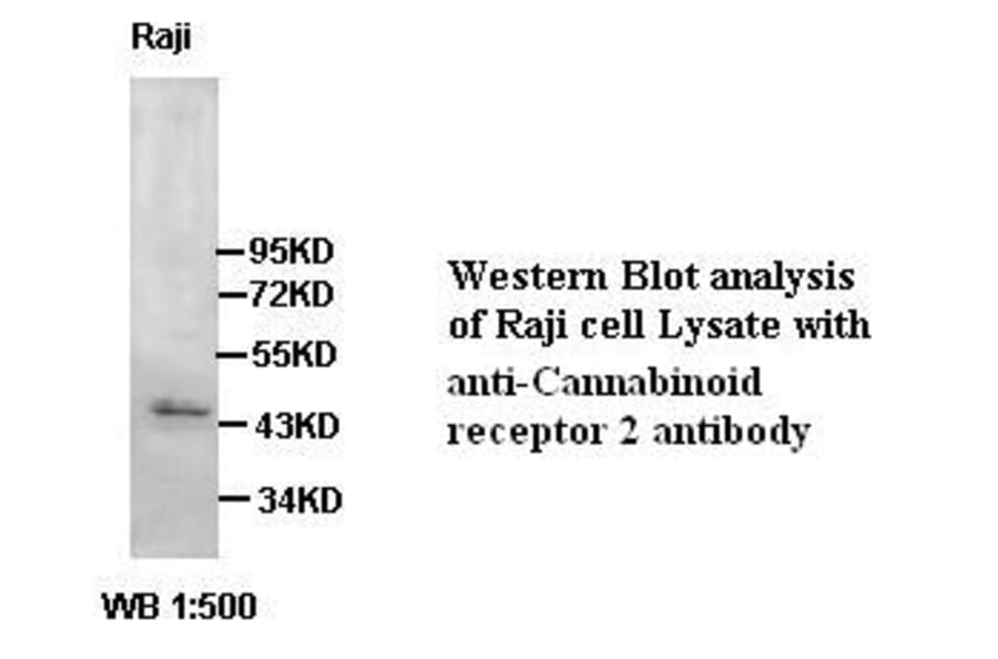 Cannabinoid receptor 2 Antibody from Signalway Antibody (39417) - Antibodies.com