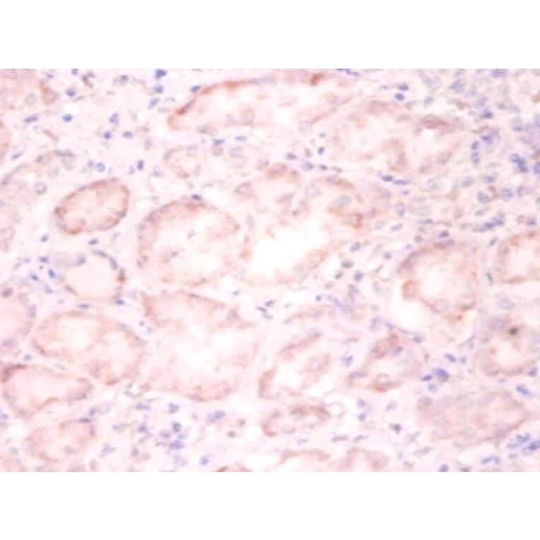 Immunohistochemistry - Histone H3.3 Polyclonal Antibody from Signalway Antibody (42256) - Antibodies.com