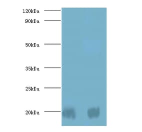 Protein DJ-1 Polyclonal Antibody from Signalway Antibody (42400) - Antibodies.com