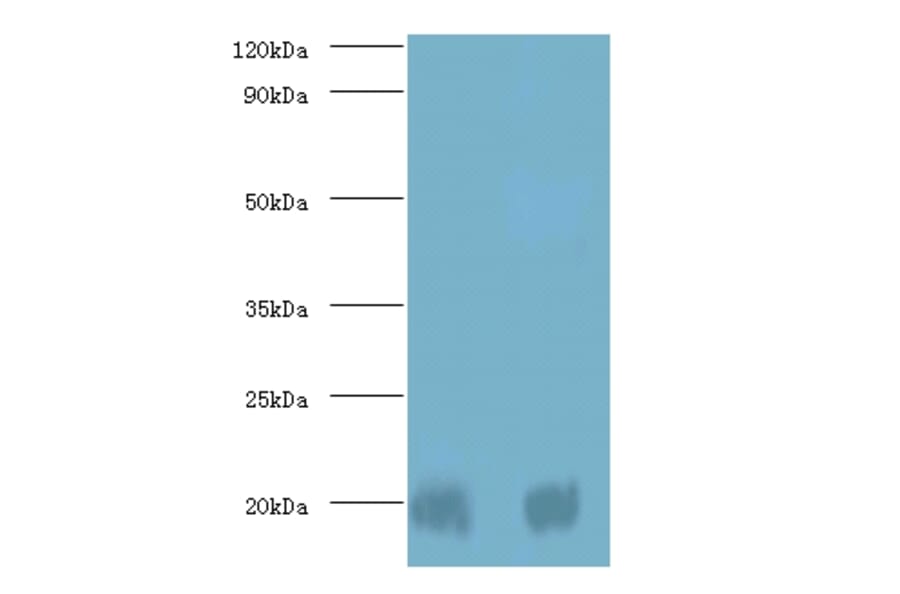 Protein DJ-1 Polyclonal Antibody from Signalway Antibody (42400) - Antibodies.com