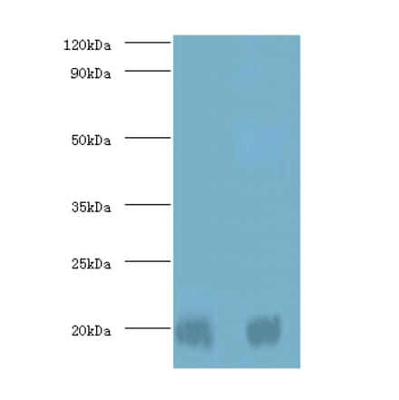 Protein DJ-1 Polyclonal Antibody from Signalway Antibody (42400) - Antibodies.com