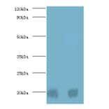 Protein DJ-1 Polyclonal Antibody from Signalway Antibody (42400) - Antibodies.com