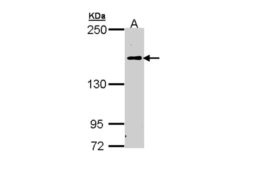 C5 antibody from Signalway Antibody (22973) - Antibodies.com