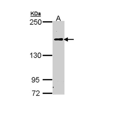 C5 antibody from Signalway Antibody (22973) - Antibodies.com