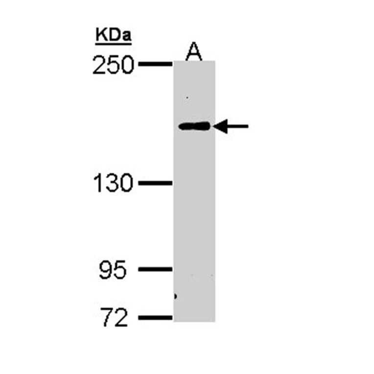 C5 antibody from Signalway Antibody (22973) - Antibodies.com