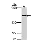 C5 antibody from Signalway Antibody (22973) - Antibodies.com