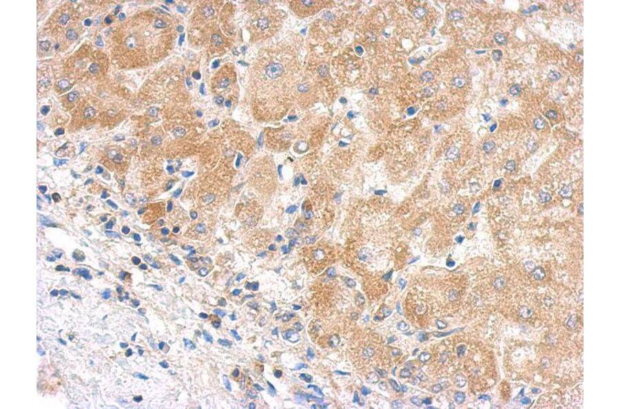 Immunohistochemistry - C5 antibody from Signalway Antibody (22973) - Antibodies.com
