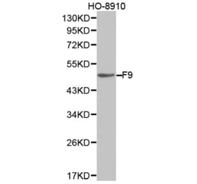 Western blot - F9 Antibody from Signalway Antibody (32323) - Antibodies.com