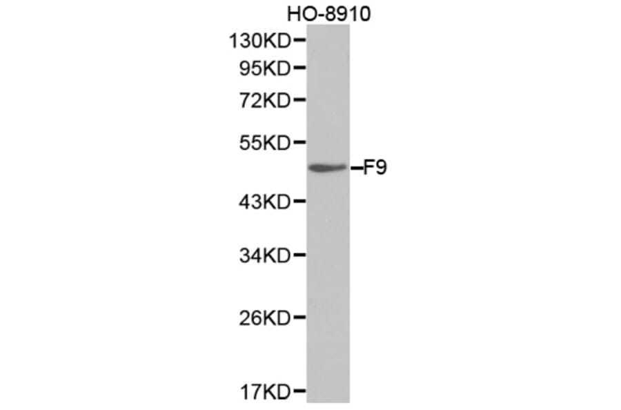 Western blot - F9 Antibody from Signalway Antibody (32323) - Antibodies.com