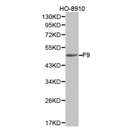 Western blot - F9 Antibody from Signalway Antibody (32323) - Antibodies.com