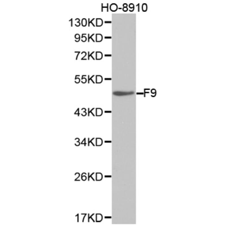 Western blot - F9 Antibody from Signalway Antibody (32323) - Antibodies.com