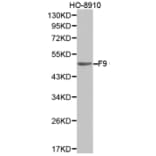 Western blot - F9 Antibody from Signalway Antibody (32323) - Antibodies.com