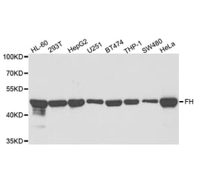 Western blot - FH Antibody from Signalway Antibody (32975) - Antibodies.com