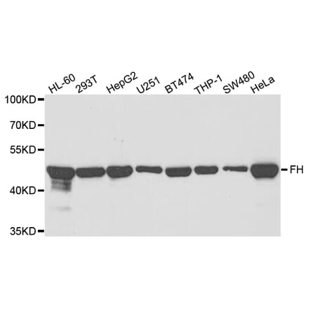 Western blot - FH Antibody from Signalway Antibody (32975) - Antibodies.com