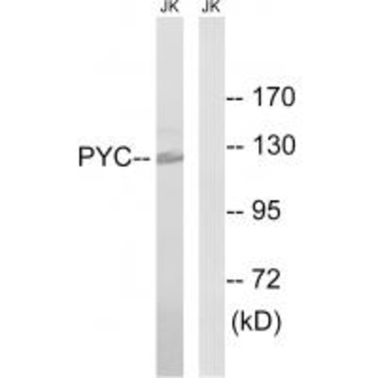 Western blot - PC Antibody from Signalway Antibody (34943) - Antibodies.com