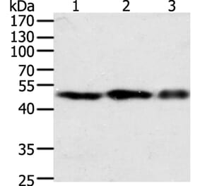 F7 Antibody from Signalway Antibody (35954) - Antibodies.com