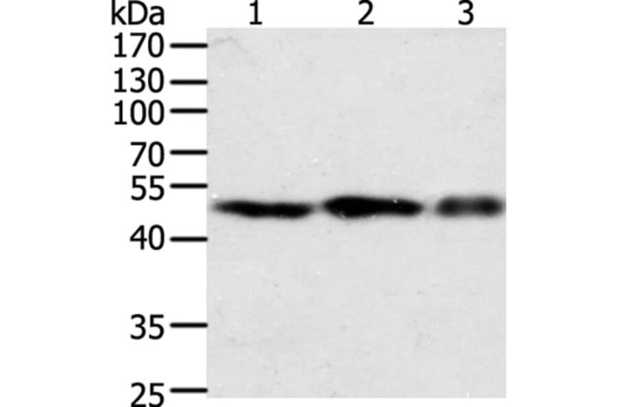 F7 Antibody from Signalway Antibody (35954) - Antibodies.com