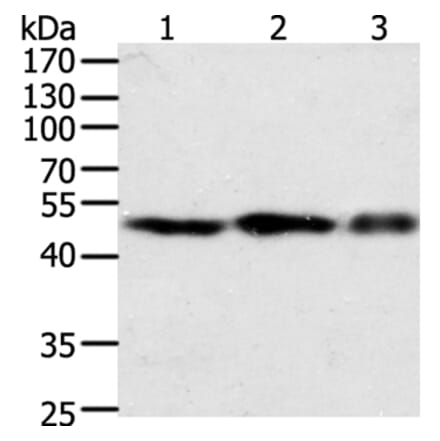F7 Antibody from Signalway Antibody (35954) - Antibodies.com