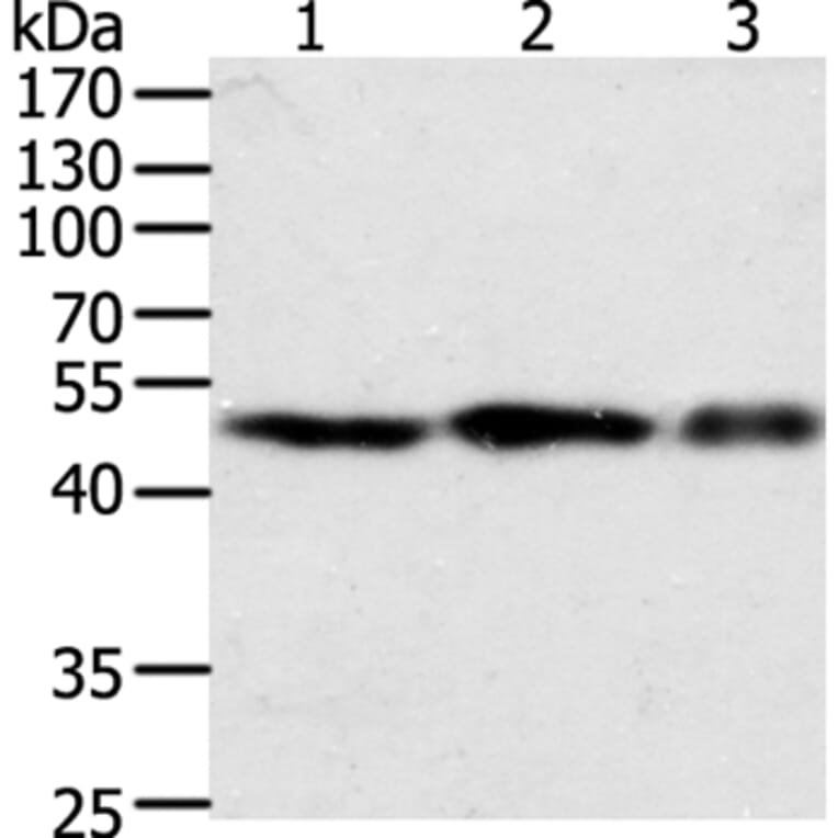 F7 Antibody from Signalway Antibody (35954) - Antibodies.com